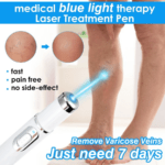 Blue-Light-Therapy-Pen-for-Varicose-Veins