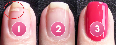 Cracked Nail Repair Gel 5 Cracked Nail Repair Gel 7